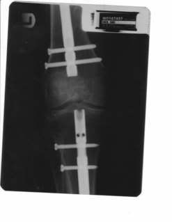 frontleg.jpg